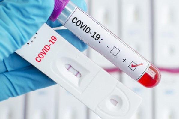 4616 са новите случаи на коронавирус у нас при направени